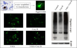 RGC Public Lectures - Life Quality of Elders (Second Session - Photo 2) - Cory B promoted degradation of pathogenic α-syn species via inducing autophagy