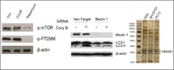 RGC Public Lectures - Life Quality of Elders (Second Session - Photo 3) - Molecular mechanism of Cory B, mTOR-independent but Beclin-1-dependent manner